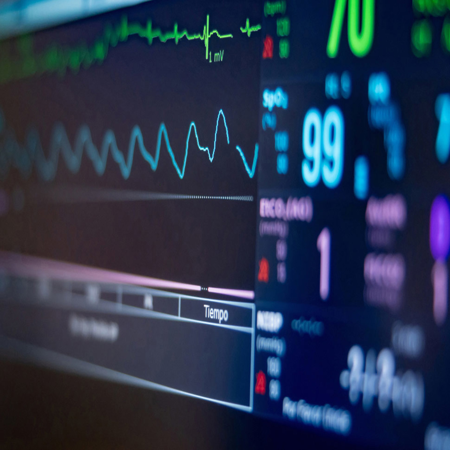 Heart monitor machine