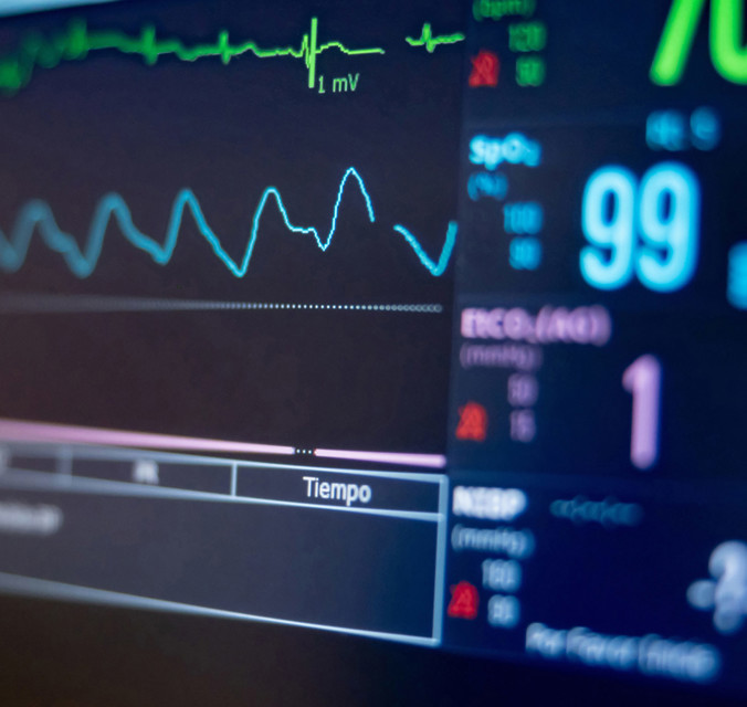 Image of a heart monitor machine screen